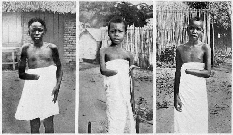 FORGOTTEN TERROR: King Leopold II mutilated and massacred Black Slaves of Congo